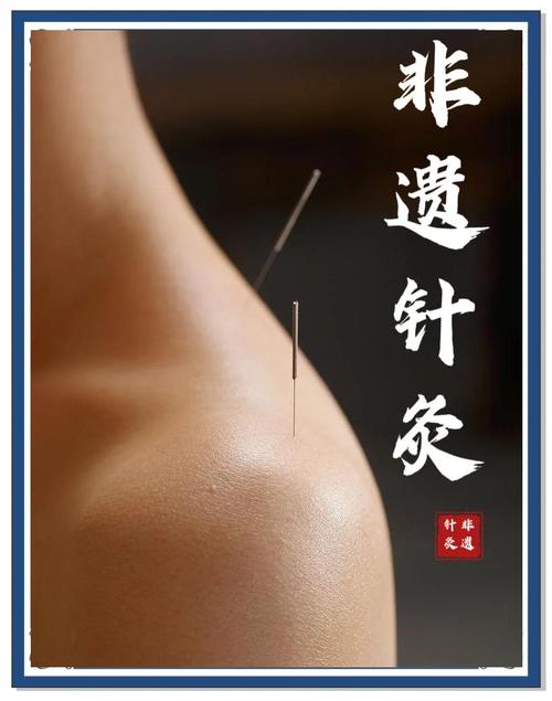 针灸治疗反流性食管炎