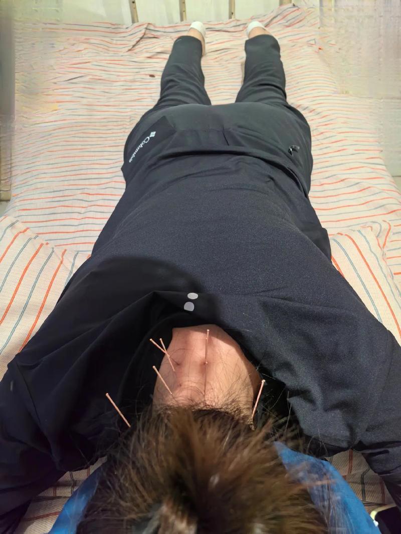 苏州中医院针灸怎么样