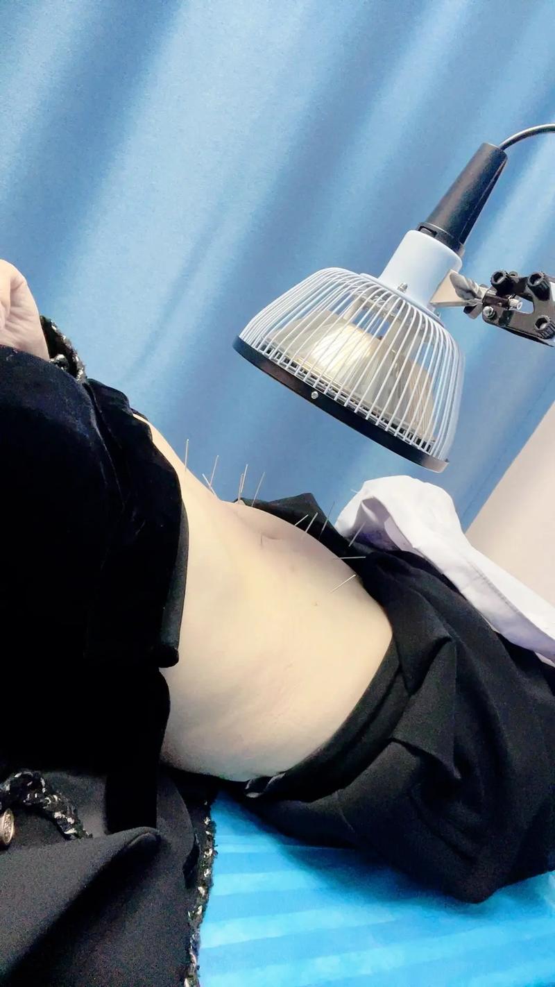 江苏省中医院针灸减肥