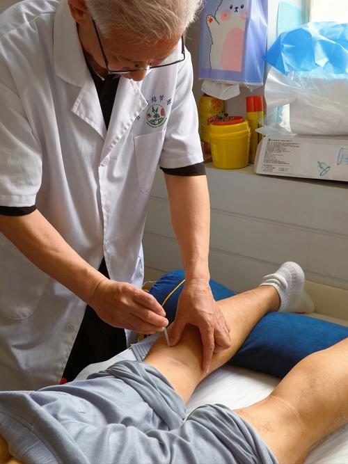 针灸治疗梨状肌综合症