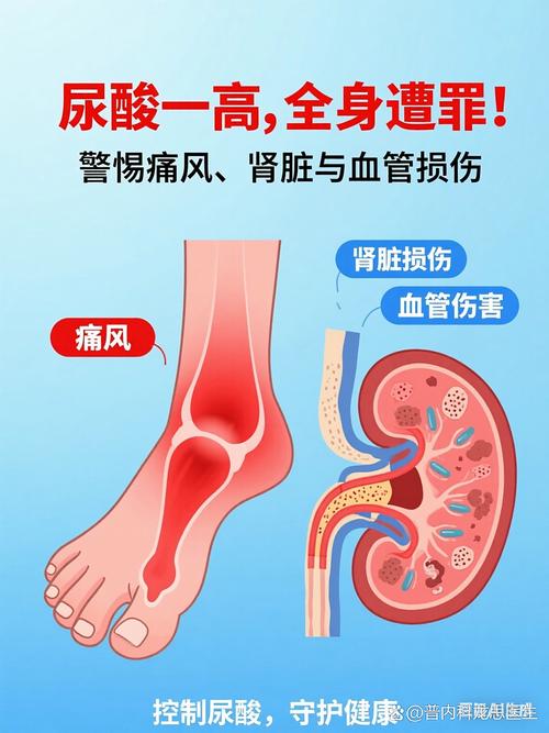 痛风跟肾脏有关系没有