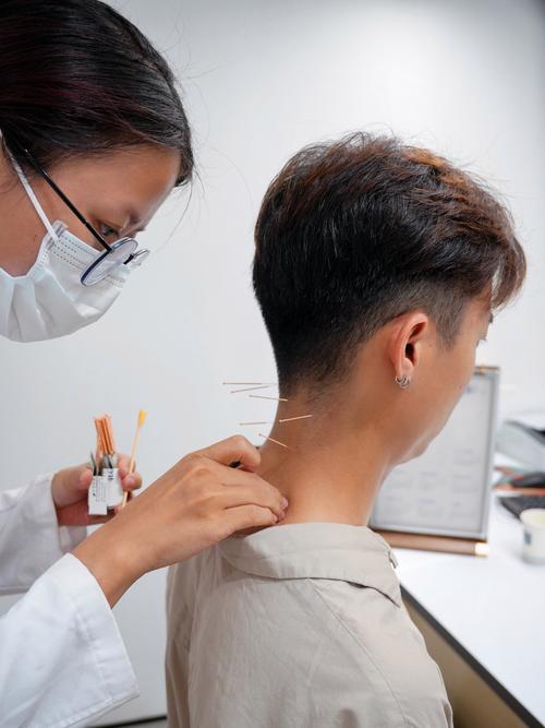 颈椎病针灸可以治好吗