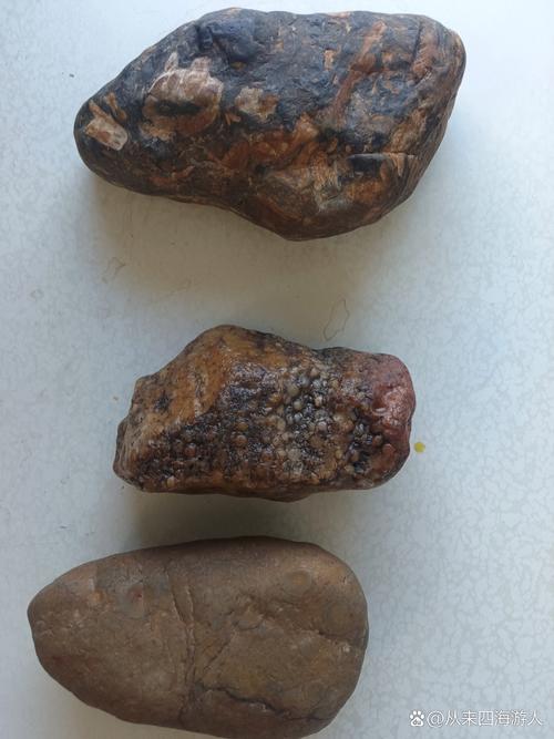 东革阿里 痛风石溶解