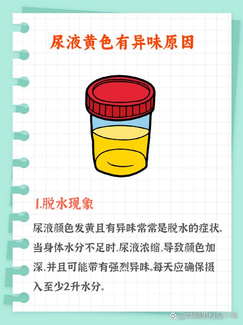 痛风为什么要碱化尿液