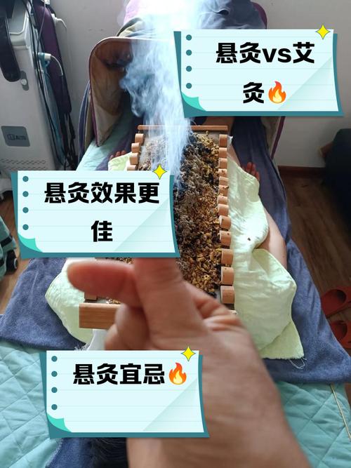 艾灸和针灸有什么区别
