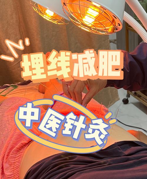 埋线针灸减肥多久见效