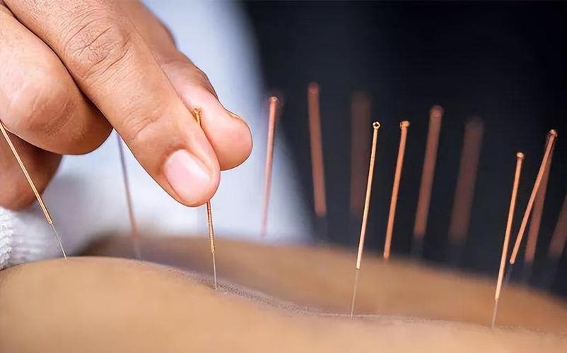 针灸治疗胃肠功能紊乱