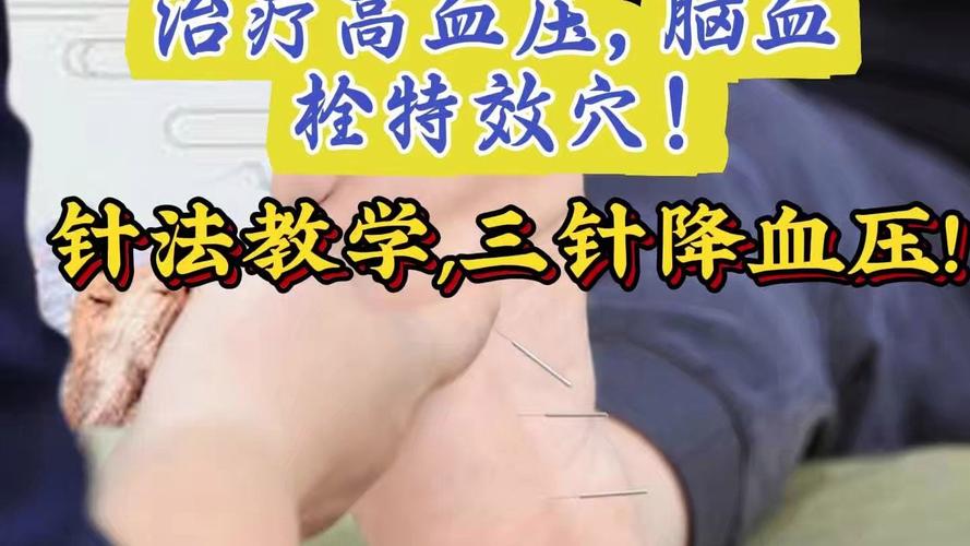 针灸治疗高血压的穴位