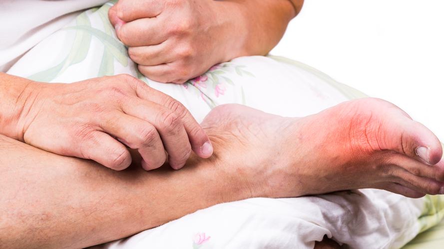 愿意嫁给痛风的男友吗