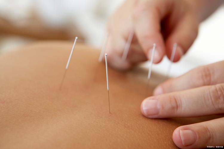 铜陵哪里有针灸减肥的