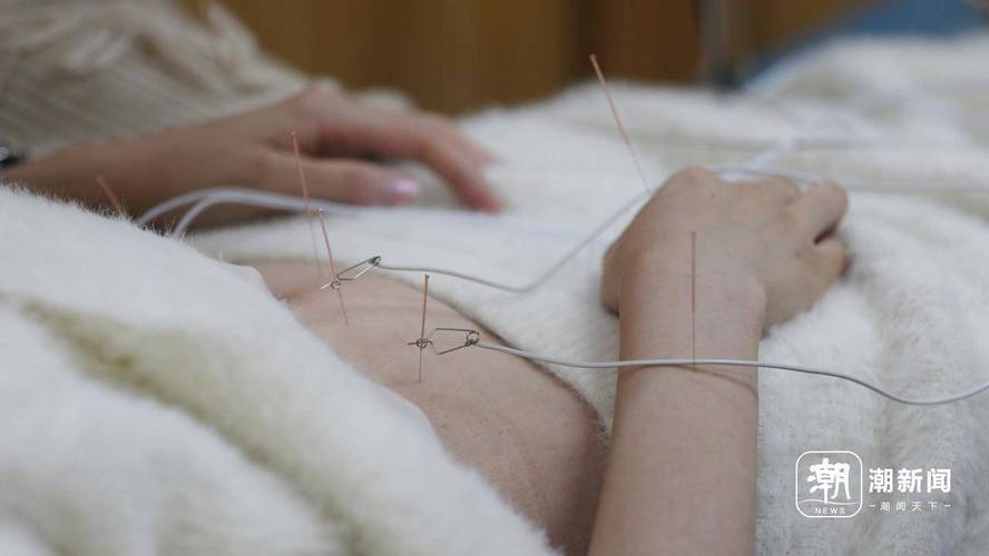 青岛海慈医院针灸减肥