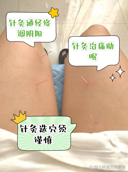 针灸可以让奶水变多吗