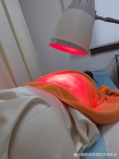 针灸 子宫内膜异位症