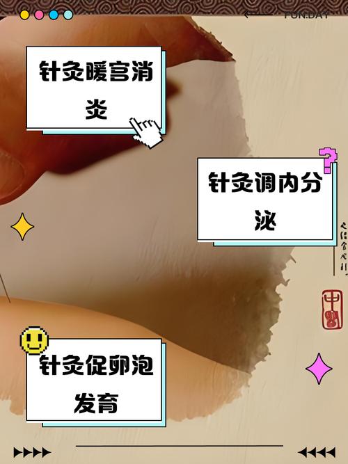 针灸 子宫内膜异位症