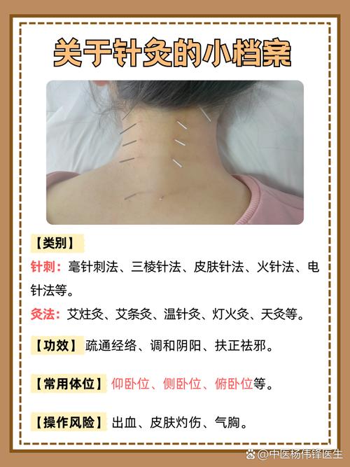 上海针灸 多少钱一次