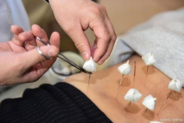 重庆市中医院针灸减肥