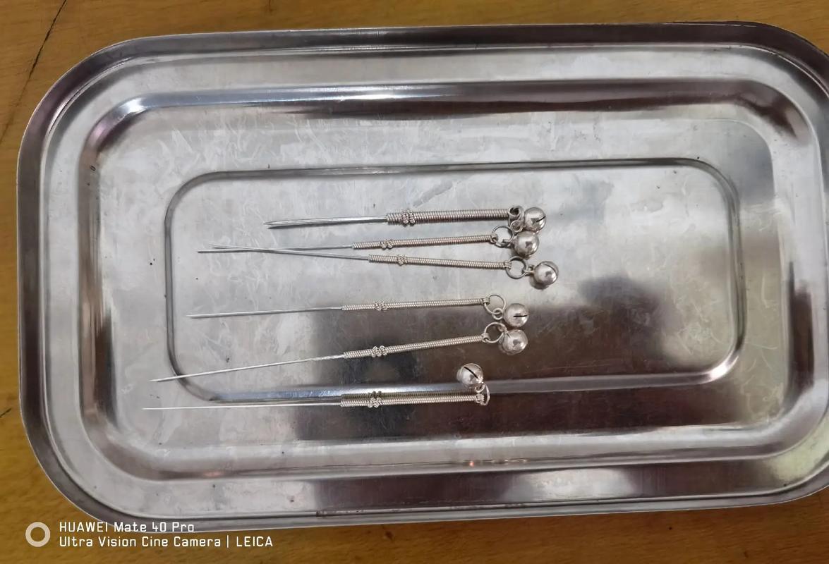 哪里有卖用针灸用的针