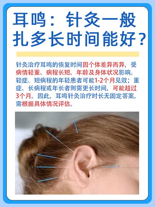 耳鸣针灸 多少钱一次