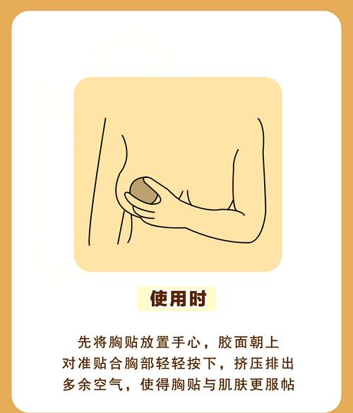 贴针灸丰胸真的有用吗