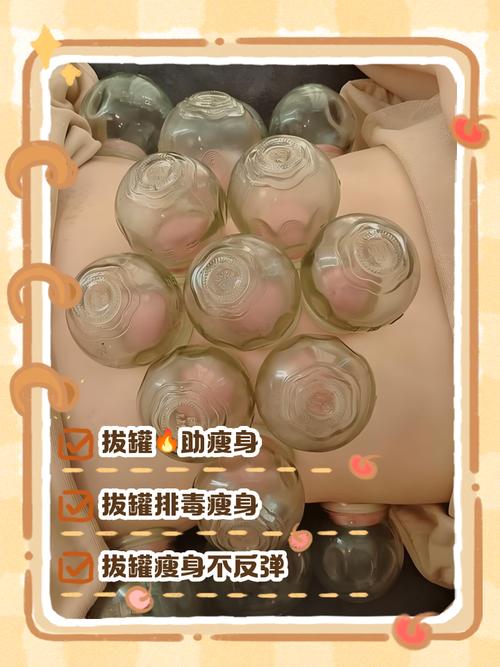 减肥针灸好还是拔罐好