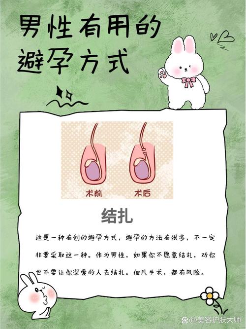 安全避孕的方法有哪些