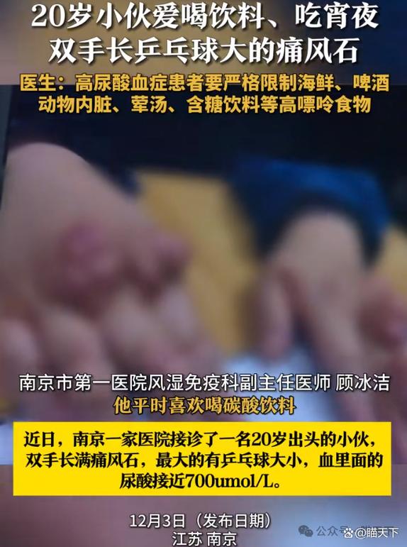 为什么喝饮料会得痛风