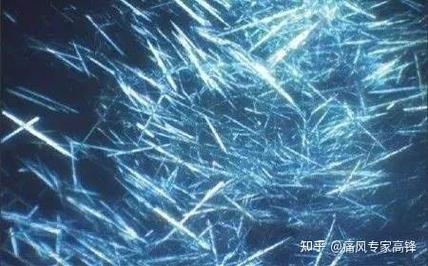 痛风脚关节为什么黑色