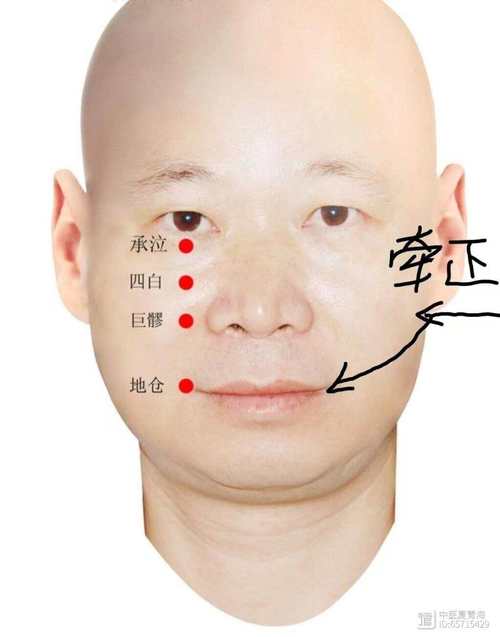 面神经麻痹的针灸穴位