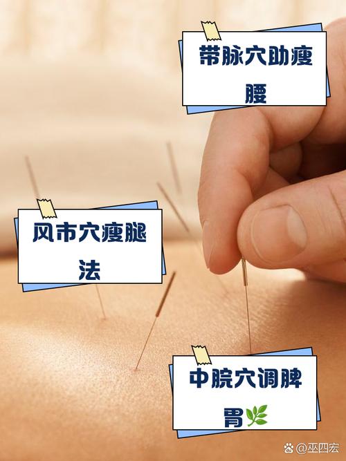 针灸减肥可以瘦多少斤