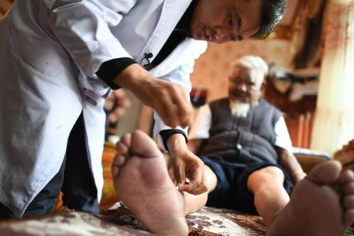 帕金森 综合症 针灸