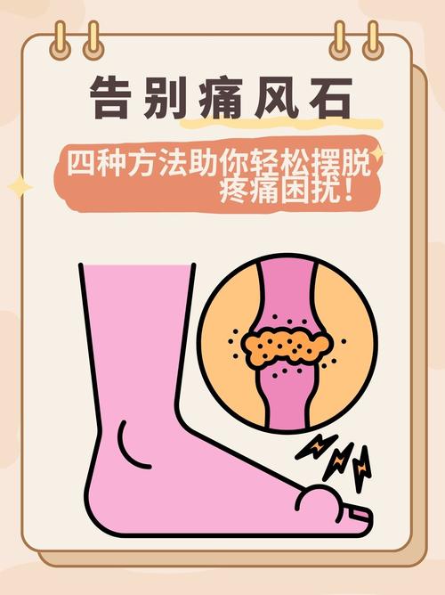 痛风石按摩可以消除吗