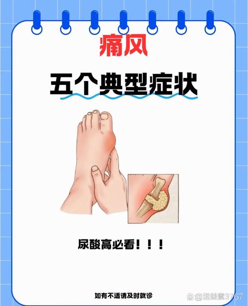 痛风影响体质生男孩吗