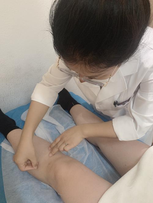 针灸减肥是天天针灸吗