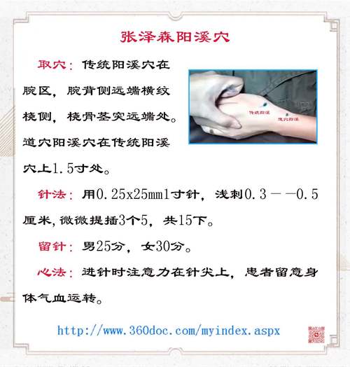 针灸对中风的治疗方法