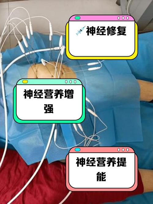 神经官能症的针灸治疗