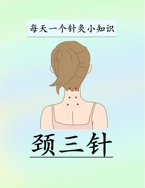 颈椎病的针灸治疗穴位