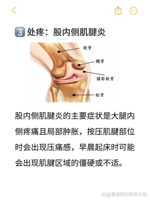 膝盖突然肿痛是痛风吗