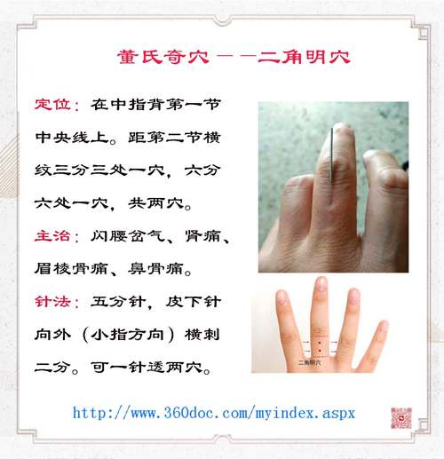 董氏奇穴针灸 PDF