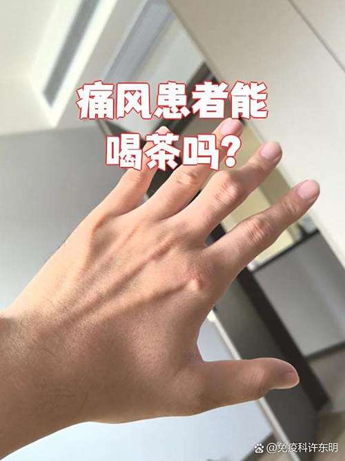 痛风的时候可以喝茶吗