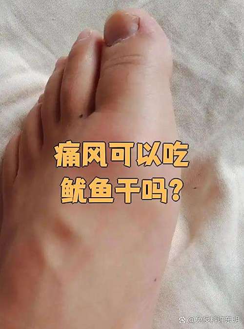 痛风患者可以吃鱿鱼吗