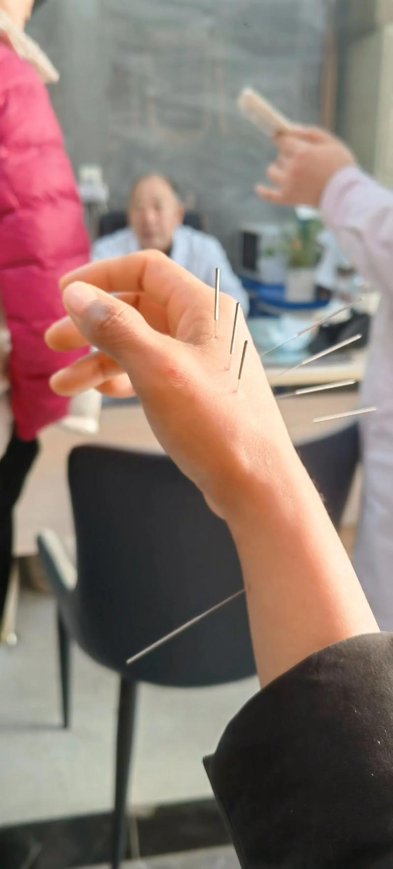 浙江中医药大学 针灸