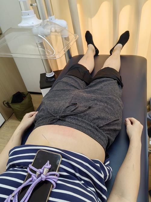 上海中医药大学 针灸