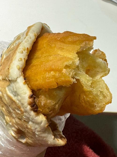 痛风可以吃大饼油条吗