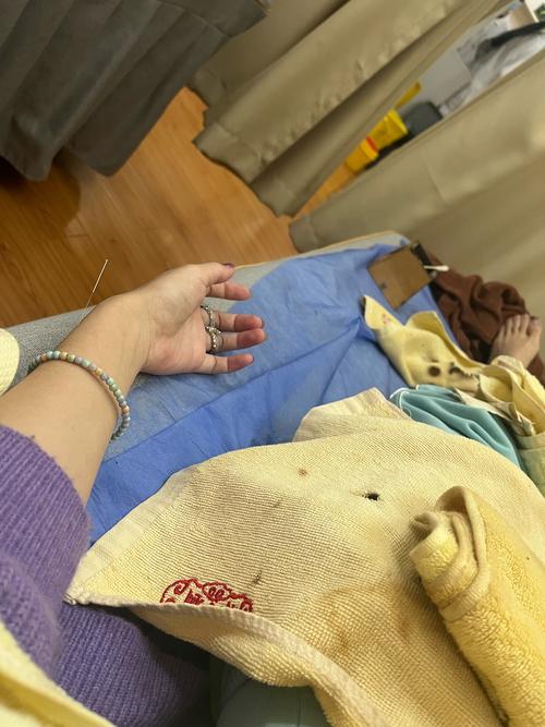 广州中医药大学 针灸