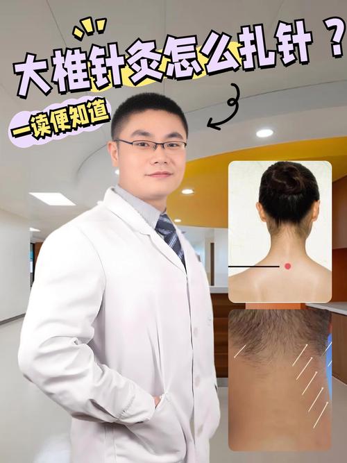 强直性脊柱炎能针灸吗