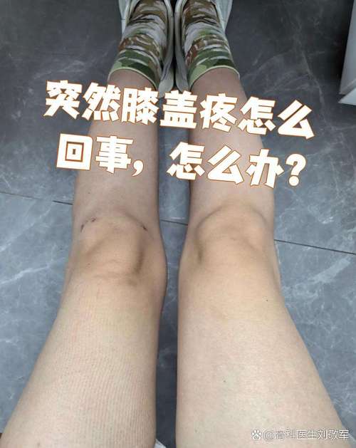 痛风导致膝盖痛的症状