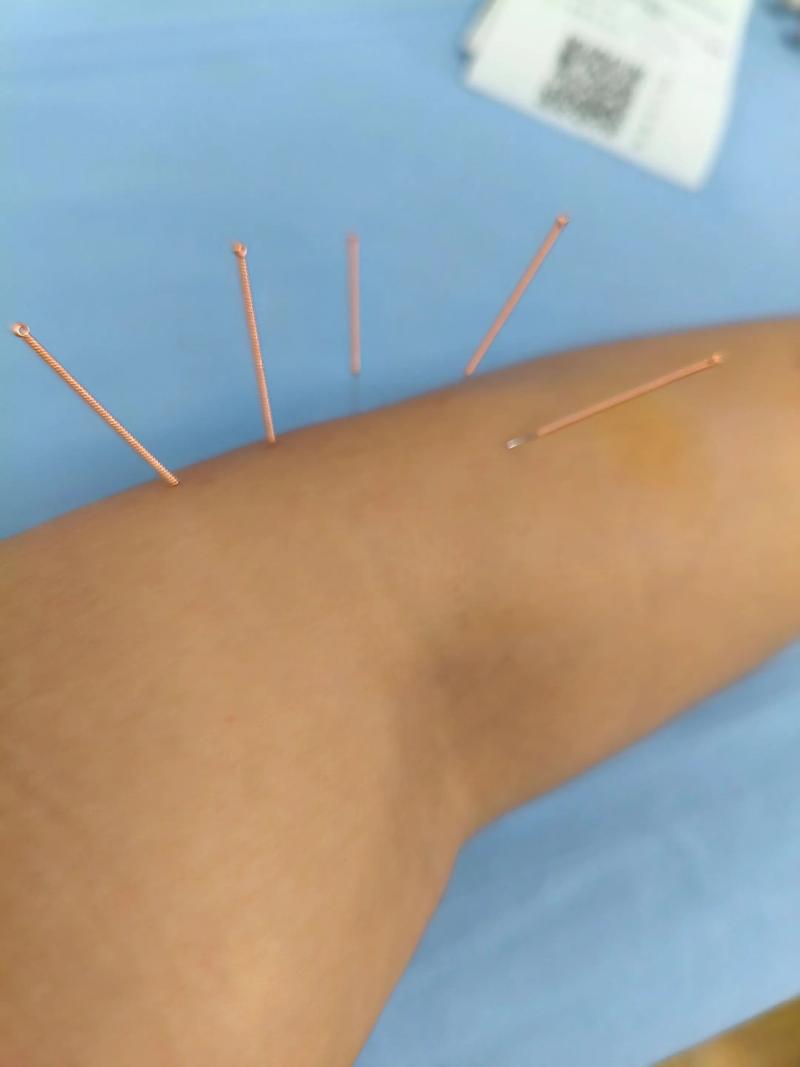 南方医科大学针灸专业