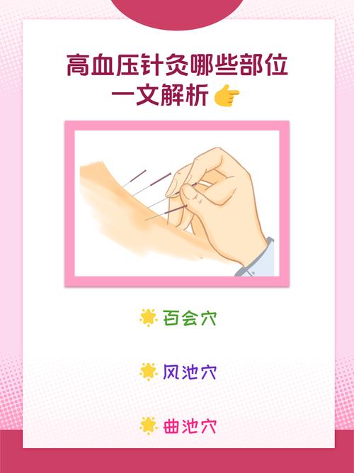 高血压心脏病能针灸吗