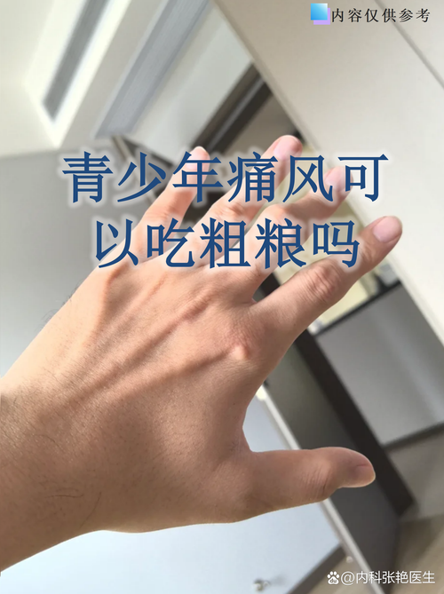 老公痛风生女孩几率大