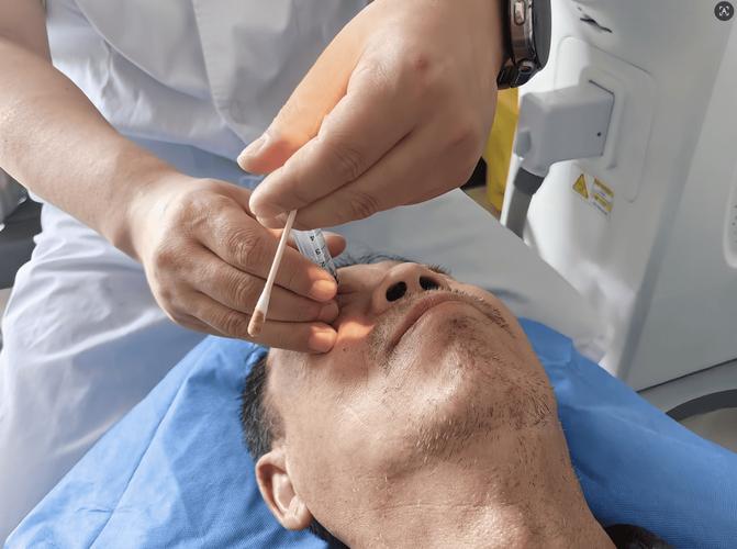 江苏省中医院眼部针灸